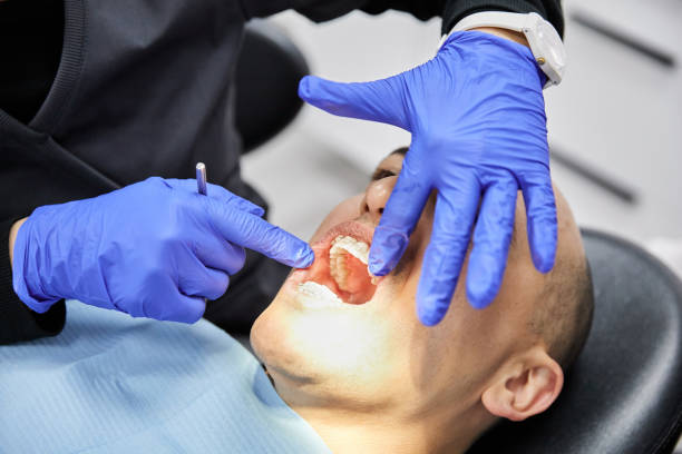 Best Emergency Broken Tooth Repair in Coker, AL