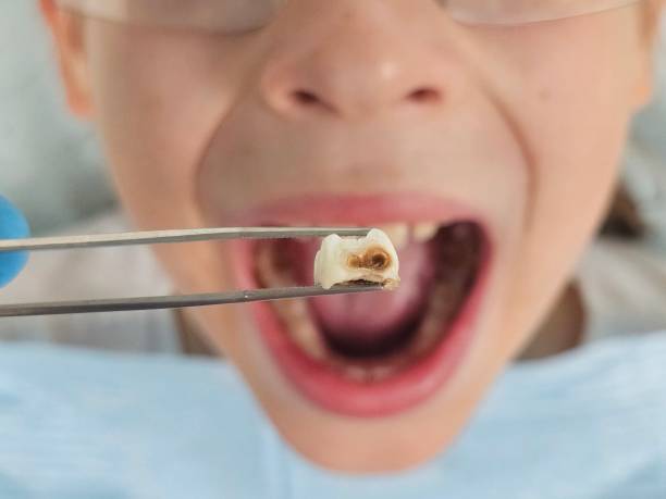 Best Emergency Dental Care for Trauma or Injury in Coker, AL