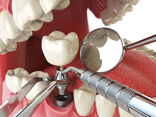 Best Weekend Emergency Dentist in Coker, AL